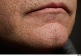  HD Face skin references Saahir Nasir lips mouth pores skin texture 0003.jpg